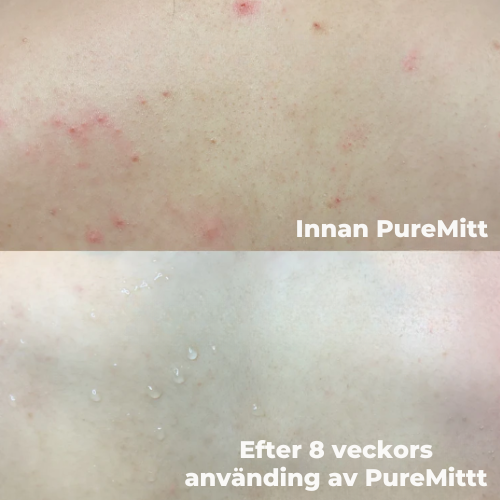 PureMitt - Peelinghandske